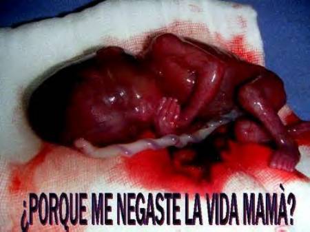 Videos-De-Abortos-Reales VER imagenes de abortos reales para compartir - taringa noticias ...